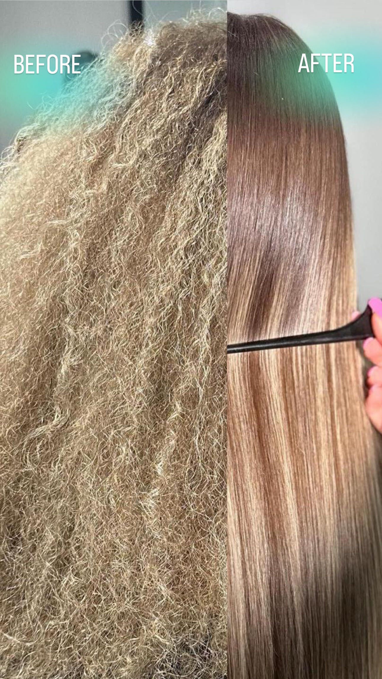 Nanoplastia before and after at de Payolle Orlando