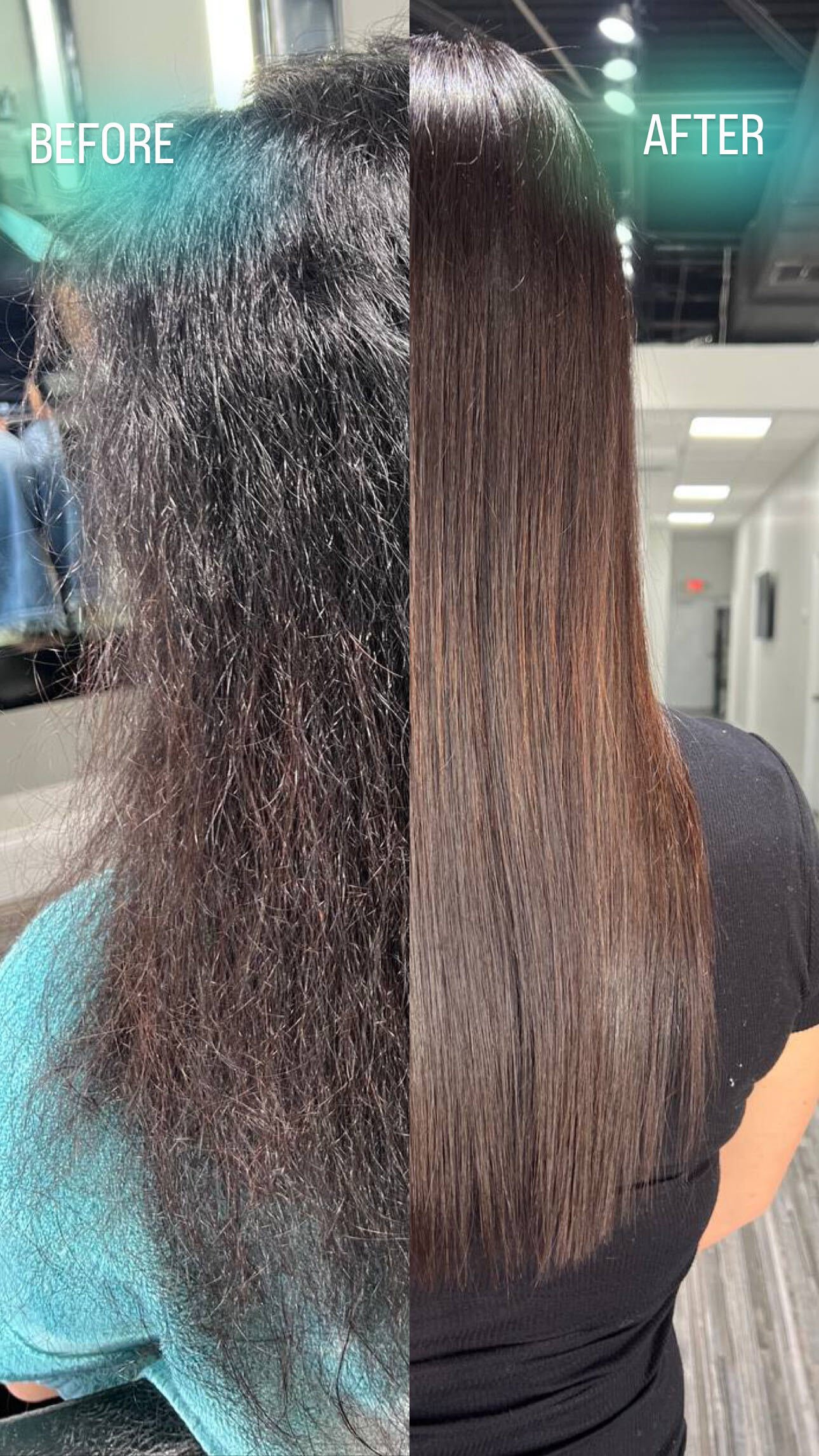 Nanoplastia before and after at de Payolle Orlando