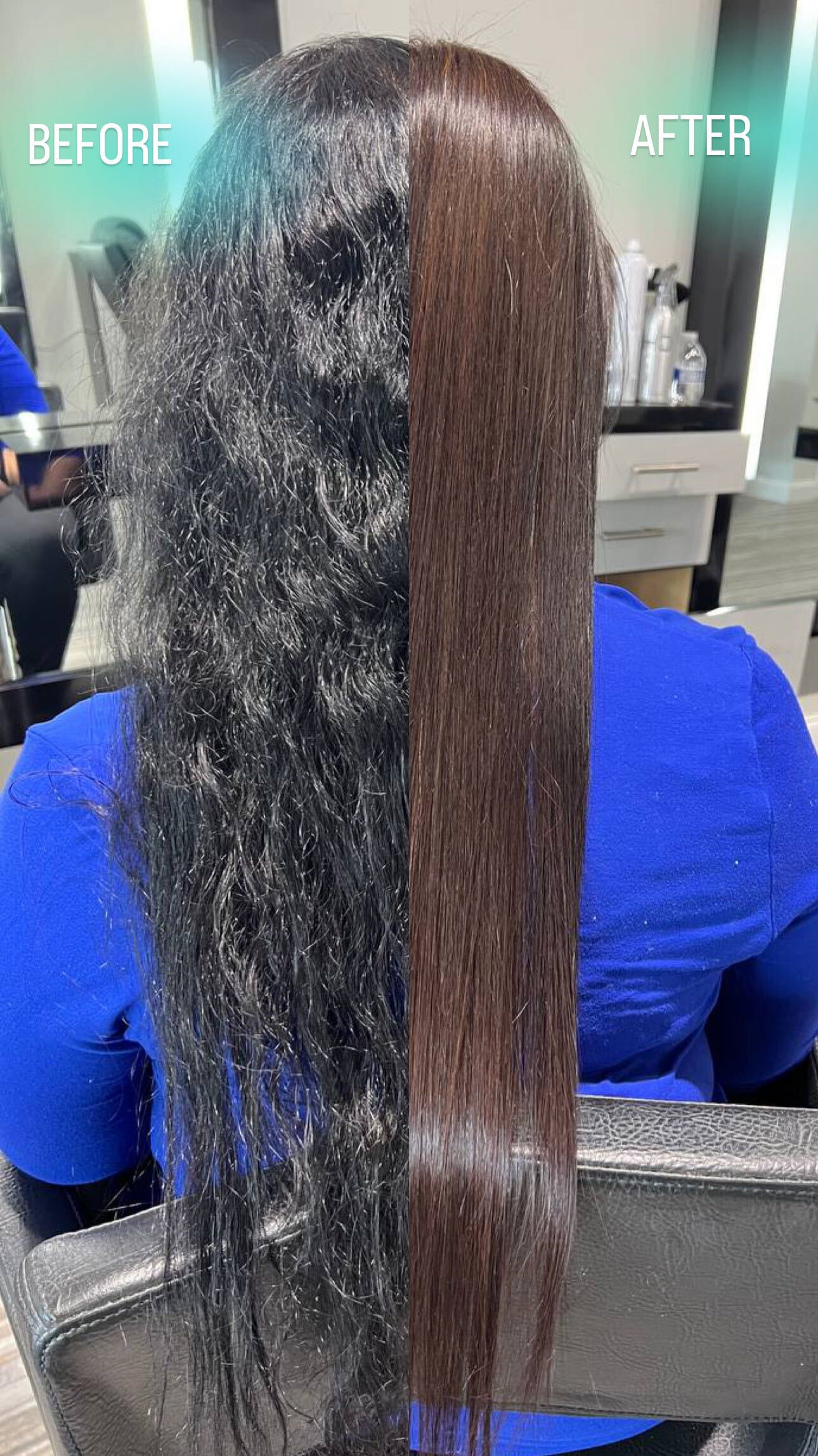 Nanoplastia before and after at de Payolle Orlando