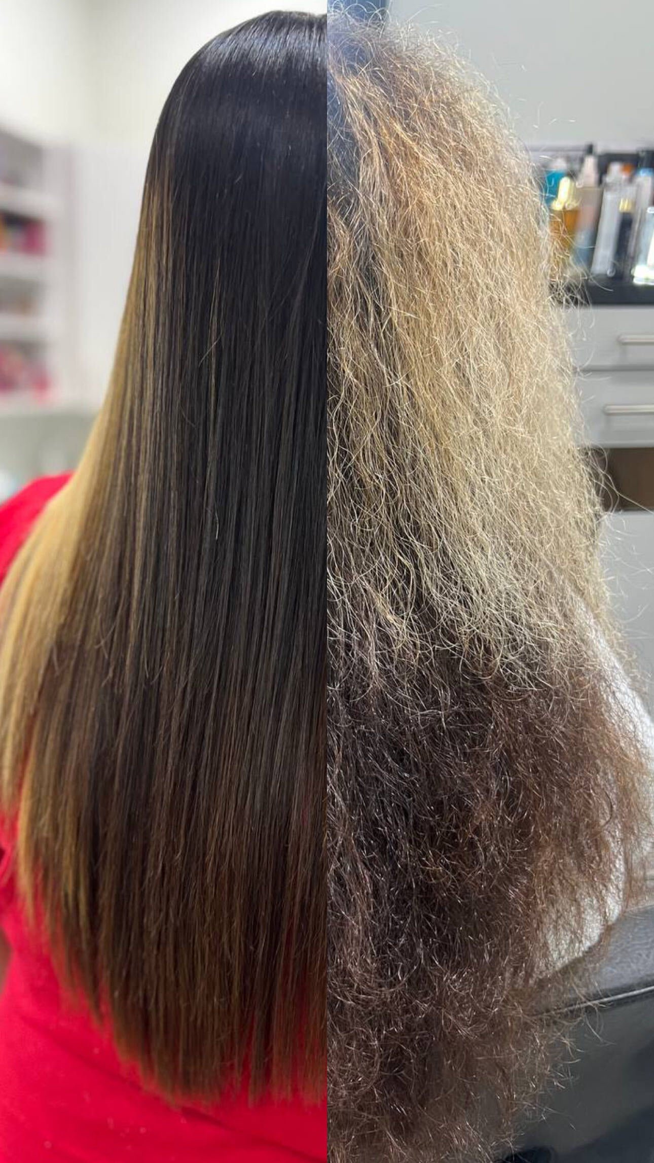Nanoplastia before and after at de Payolle Orlando