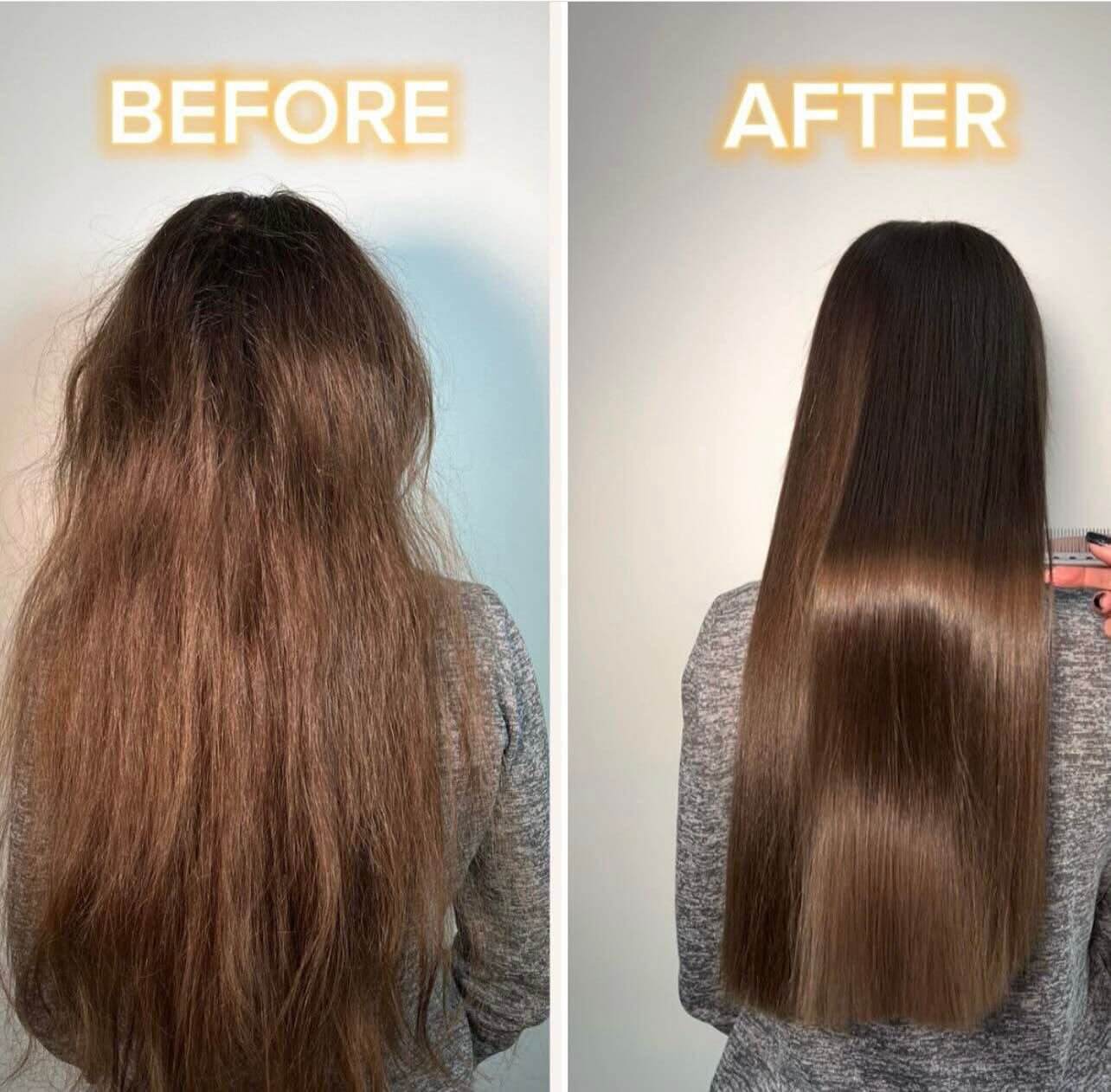 Nanoplastia before and after at de Payolle Orlando